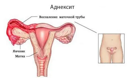 Защо получавам заядлив болка в дясната си страна