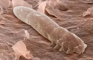 Bőr alá Demodex atkák egy személy arcát tünetei és kezelése