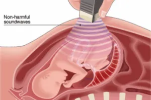 Cauzele de oncologie, oncologie, pediatrie tratamentul cancerului