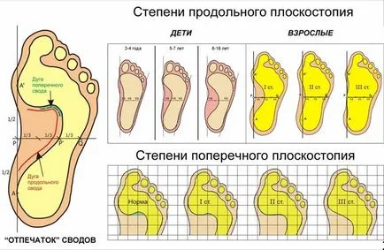 Предотвратяване на плоско стъпало при деца на различна възраст