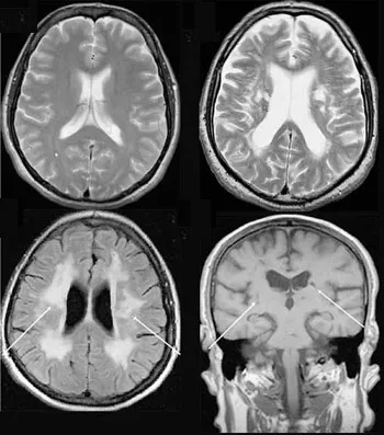 X-ray, CT și RMN-ul care este diferența