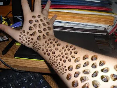 Trypophobia - ce este așa cum apare