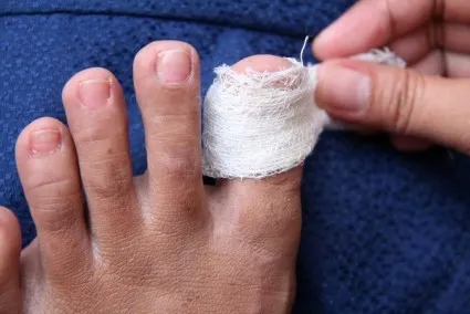 Eliminarea toenail ciuperca cu metodele, de recuperare