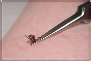 mușcături de insecte - de protecție și de prim ajutor, doc