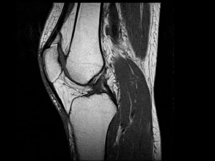 articulația genunchiului Uzi, arătând diagnosticul cu ultrasunete a genunchiului