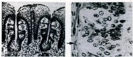 sisteme ale corpului (histologie) - Limba