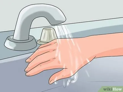 Hogyan kell kezelni égési sérülést forró víz