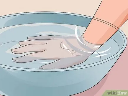 Cum de a trata arsurile pielii cu apă caldă