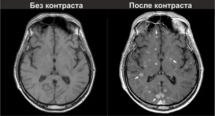 Agentul de contrast în IRM - indicații, contraindicații, informații generale