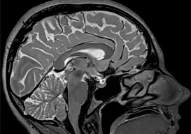 Órás MRI diagnosztikai a klinikán tsmrt ENEA