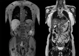 Órás MRI diagnosztikai a klinikán tsmrt ENEA