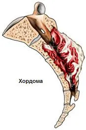 RMN al sacrum si coccis, coloana sacral care arată prepararea sau o radiografie