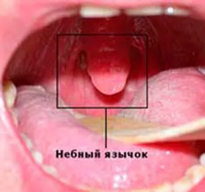 Увулата подуто и зачервено