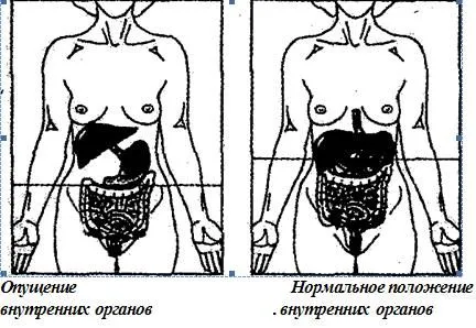 Пропускането на стомашни симптоми и причини - gastroptosis лечение в клиниката 