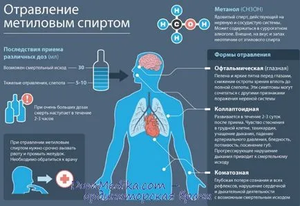 Отравяне с метилов алкохол