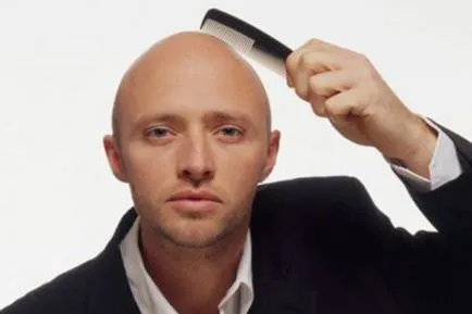 Miért hajhullás férfiaknál korán, okai hajhullás a férfiak akár 25 éves -
