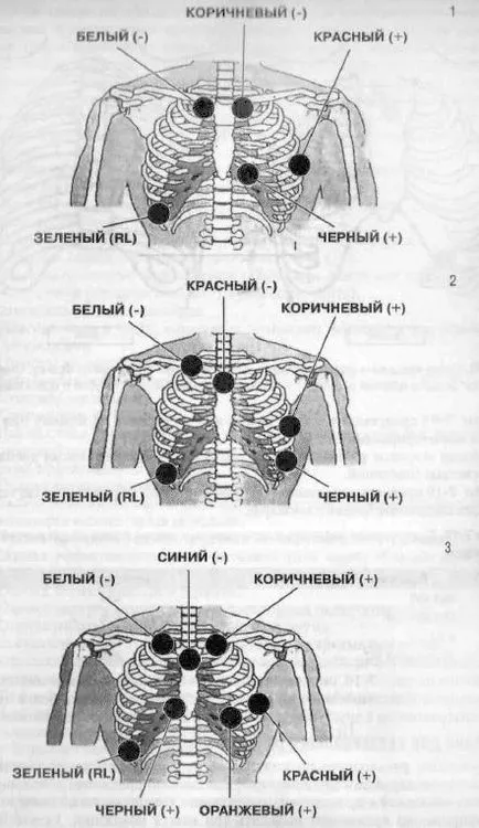 Timpul de înregistrare și selectarea Holter plumb