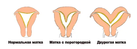 місячних