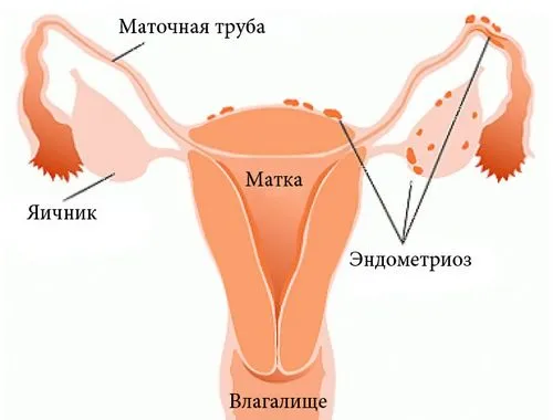 циклу