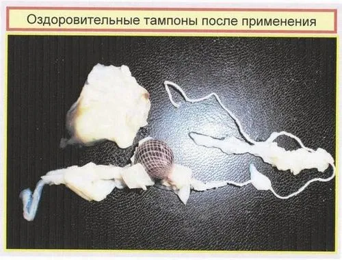 кров