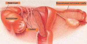 після