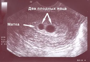 вагітності