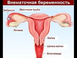 місячні