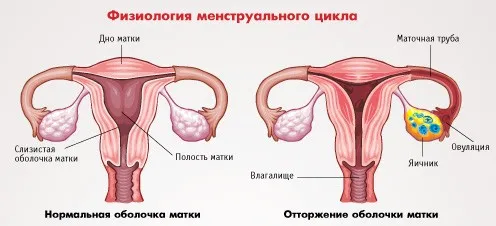 Болі при менструації: нормальне явище або ж краще звернутися за консультацією до гінеколога місячних