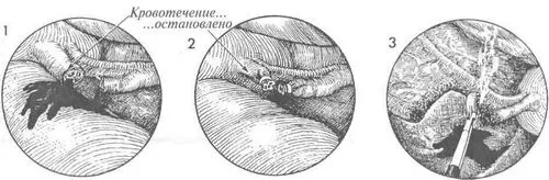 циклу