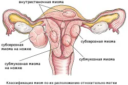 болить