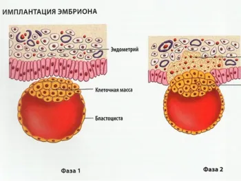 лікаря