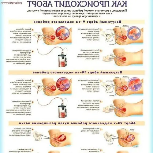 циклу