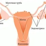 чим загрожує відсутність місячних
