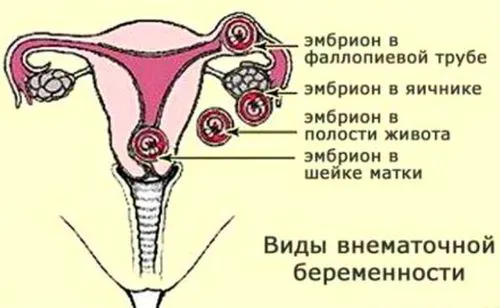 місячних