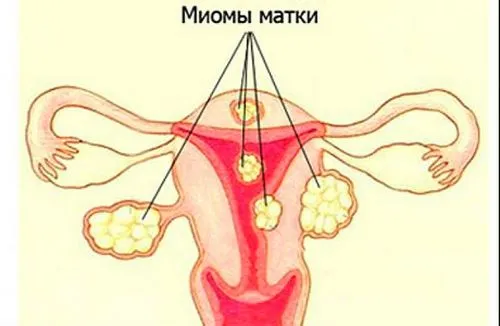 місячних