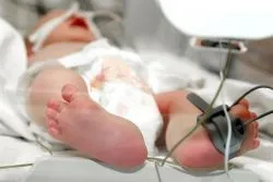 передчасні пологи на 30 тижні вагітності