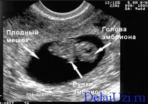 узі