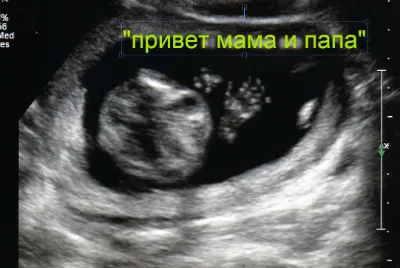 вагітність 16 тижнів