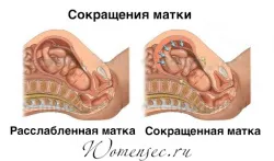 тонус матки при вагітності лікування