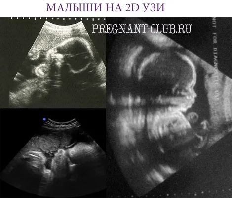 вагітність 28 29 тижнів