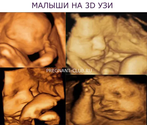 29 тиждень вагітності фото відео дитина розвиток
