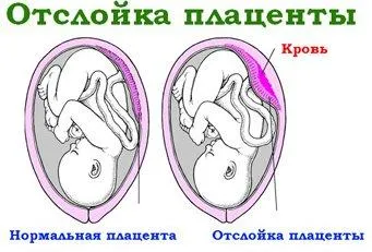 дуже