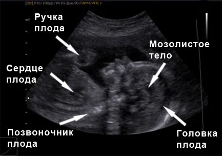 25 тиждень вагітності опис