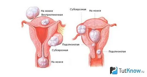 відео