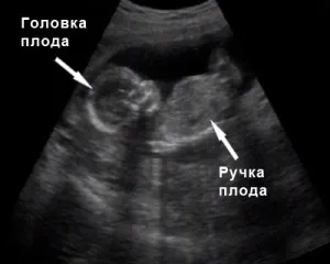 вагітність 15 тиждень