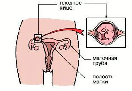 помітних