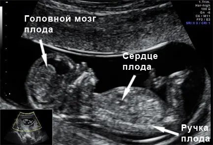 може