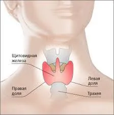 Заболявания на щитовидната жлеза и симптоми