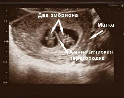 розвиток ембріона