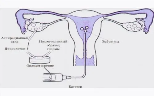 як підрахувати термін вагітності після еко